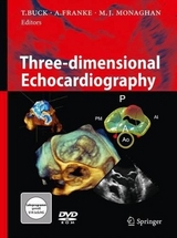 Three-dimensional Echocardiography - 