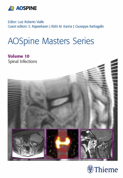 AOSpine Masters Series, Volume 10: Spinal Infections - 