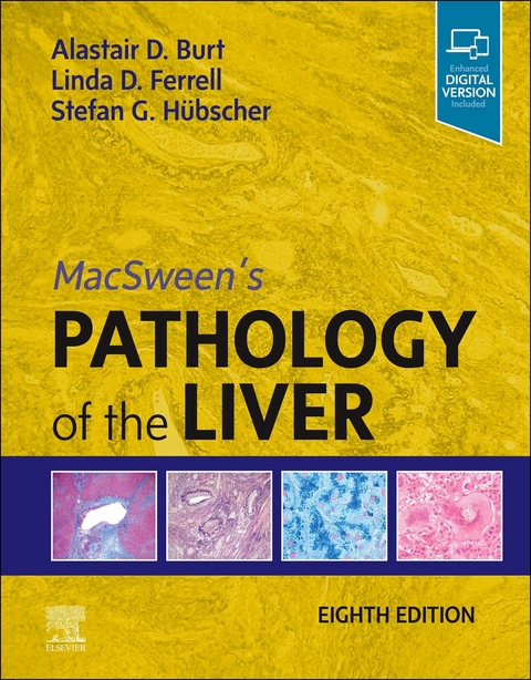 MacSween's Pathology of the Liver, E-Book -  Alastair D. Burt,  Linda D. Ferrell,  Stefan G Hubscher