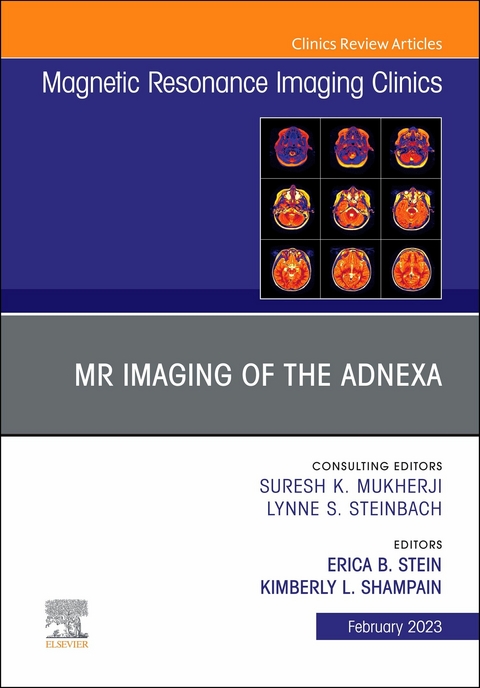 Vascular Anesthesia, An Issue of Anesthesiology Clinics, E-Book - 