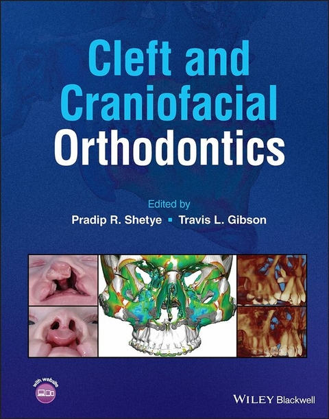 Cleft and Craniofacial Orthodontics - 