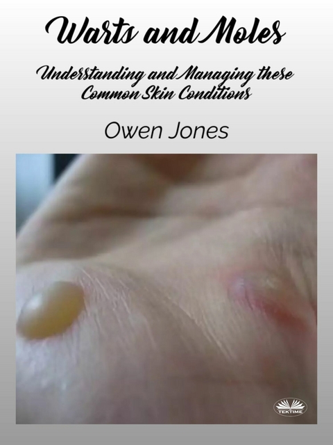 Warts And Moles - Owen Jones