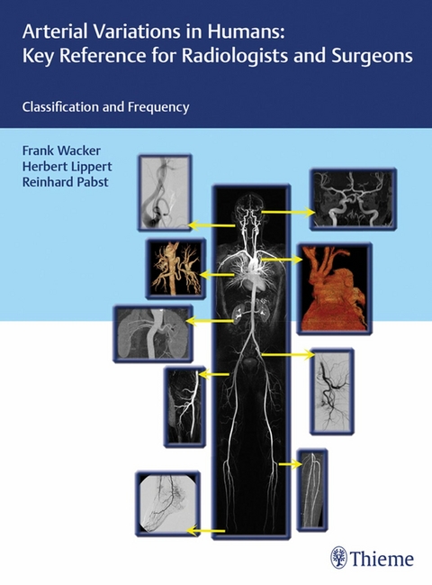 Arterial Variations in Humans: Key Reference for Radiologists and Surgeons - 