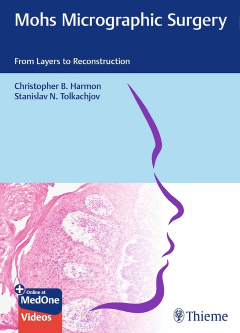 Mohs Micrographic Surgery: From Layers to Reconstruction - Christopher B. Harmon, Stanislav N. Tolkachjov