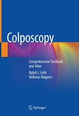 Colposcopy - Ralph J. Lellé, Volkmar Küppers