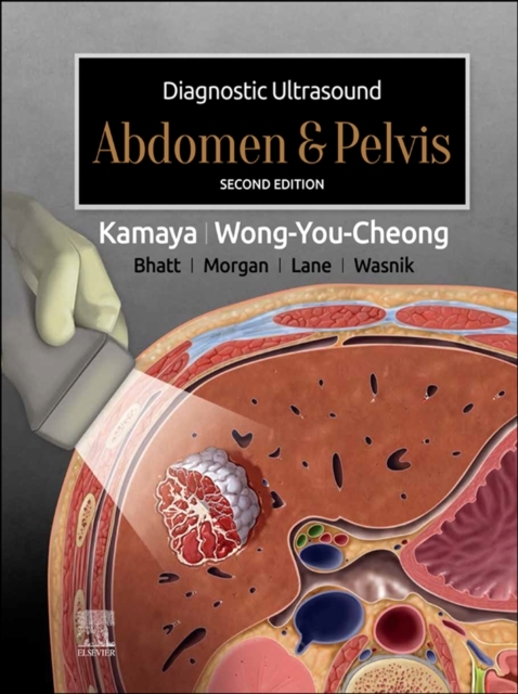 Diagnostic Ultrasound: Abdomen and Pelvis E-Book -  Aya Kamaya,  Jade Wong-You-Cheong