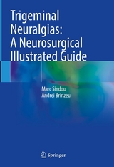 Trigeminal Neuralgias: A Neurosurgical Illustrated Guide - Marc Sindou, Andrei Brinzeu