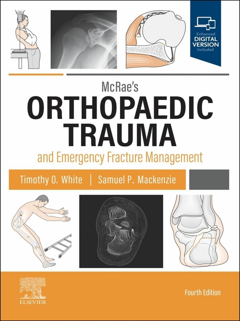 McRae's Orthopaedic Trauma and Emergency Fracture Management E-Book -  Timothy O White,  Samuel P Mackenzie