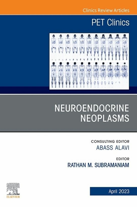 Neuroendocrine Neoplasms, An Issue of PET Clinics, E-Book - 