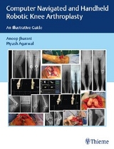 Computer Navigated and Handheld Robotic Knee Arthroplasty - Anoop Jhurani, Piyush Agarwal