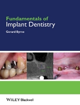 Fundamentals of Implant Dentistry -  Gerard Byrne