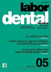 Labor Dental Técnica Nº5 Vol.25