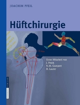 Hüftchirurgie - Joachim Pfeil