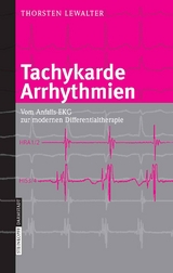 Tachykarde Arrhythmien - Thorsten Lewalter