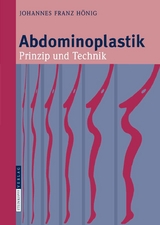 Abdominoplastik - Johannes-Franz Hönig