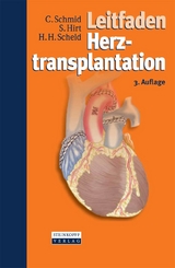 Leitfaden Herztransplantation - Christof Schmid, Stephan Hirt, Hans Heinrich Scheld