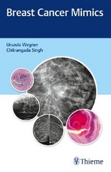 Breast Cancer Mimics - Urszula Wegner, Chitrangada Singh