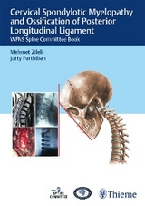 Cervical Spondylotic Myelopathy and Ossification of Posterior Longitudinal Ligament - 