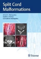 Split Cord Malformations - Ashok K. Mahapatra, Sachin A. Borkar, Subhashree Mahapatra