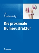 Die proximale Humerusfraktur - 