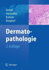 Dermatopathologie - Kempf, Werner; Hantschke, Markus; Kutzner, Heinz; Burgdorf, Walter