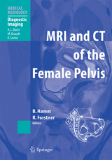 MRI and CT of the Female Pelvis - 