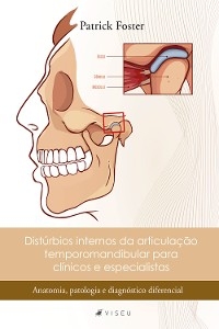 Distúrbios internos da articulação temporomandibular para clínicos e especialistas - Patrick Foster