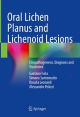 Oral Lichen Planus and Lichenoid Lesions - Gaetano Isola, Simona Santonocito, Rosalia Leonardi, Alessandro Polizzi