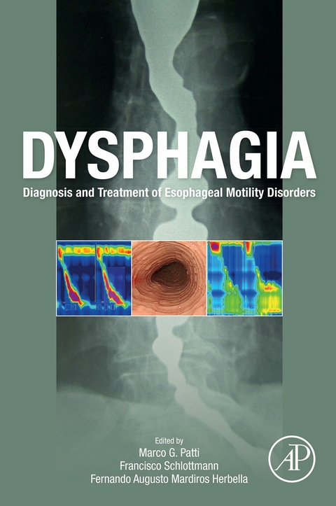 Dysphagia - 