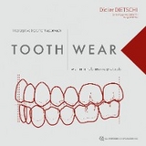 Tooth Wear - Didier Dietschi, Carlo Massimo Saratti, Serge Erpen