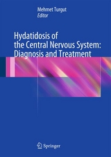 Hydatidosis of the Central Nervous System: Diagnosis and Treatment - 