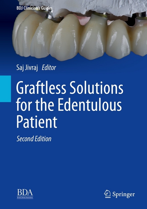 Graftless Solutions for the Edentulous Patient - 