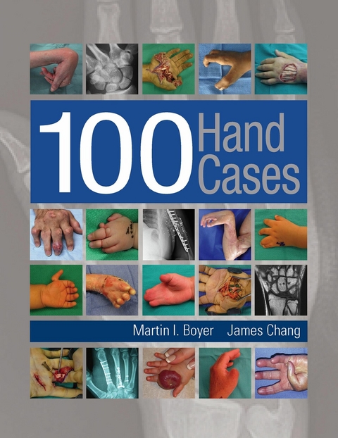 100 Hand Cases -  Martin Boyer,  James Chang