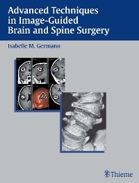 Advanced Techniques in Image-Guided Brain and Spine Surgery - Isabelle M. Germano