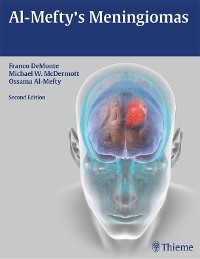 Al-Mefty's Meningiomas - 