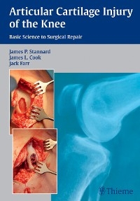 Articular Cartilage Injury of the Knee: Basic Science to Surgical Repair - 