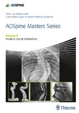 AOSpine Masters Series, Volume 9: Pediatric Spinal Deformities - 