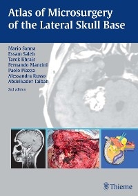 Atlas of Microsurgery of the Lateral Skull Base - Mario Sanna, Tarek Khrais, Fernando Mancini, Essam A. Saleh, Paolo Piazza, Alessandra Russo, Abdelkader Taibah