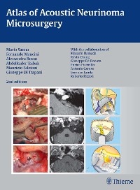 Atlas of Acoustic Neurinoma Microsurgery - Mario Sanna, Fernando Mancini, Alessandra Russo, Abdelkader Taibah, Maurizio Falcioni, Giuseppe Di Trapani