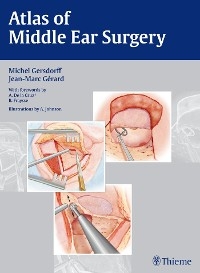 Atlas of Middle Ear Surgery - Michel Gersdorff, Jean-Marc Gérard