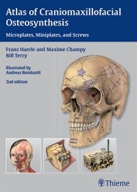 Atlas of Craniomaxillofacial Osteosynthesis - Franz Härle, Maxime Champy, Bill Terry