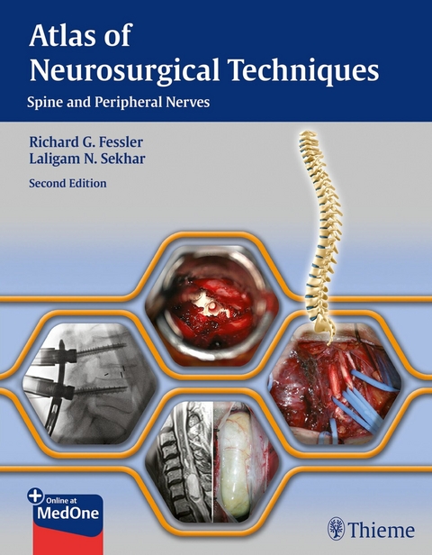 Atlas of Neurosurgical Techniques - 