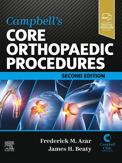 Campbell's Core Orthopaedic Procedures - 