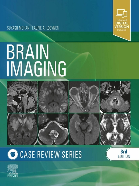 Brain Imaging: Case Review Series E-Book -  Laurie A. Loevner,  Suyash Mohan