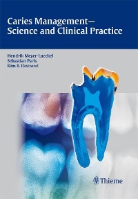 Caries Management - Science and Clinical Practice - 