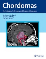 Chordomas - 