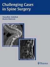 Challenging Cases in Spine Surgery - 