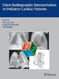 Chest Radiographic Interpretation in Pediatric Cardiac Patients - 