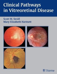 Clinical Pathways In Vitreoretinal Disease - 