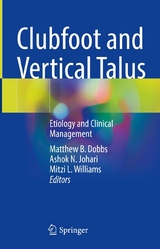 Clubfoot and Vertical Talus - 